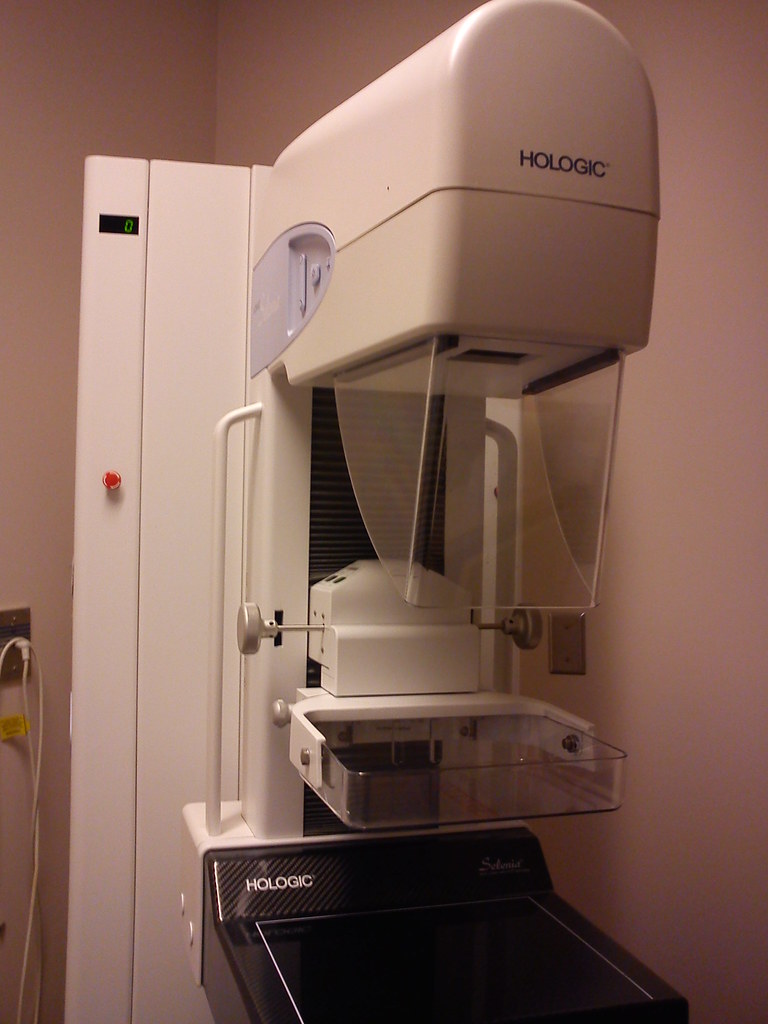 AI Mammogram Detection Cancer